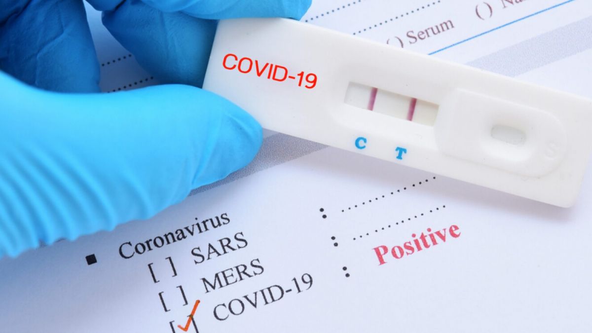 1.783 cazuri noi de COVID-19, confirmate în R. Moldova. Opt persoane au decedat