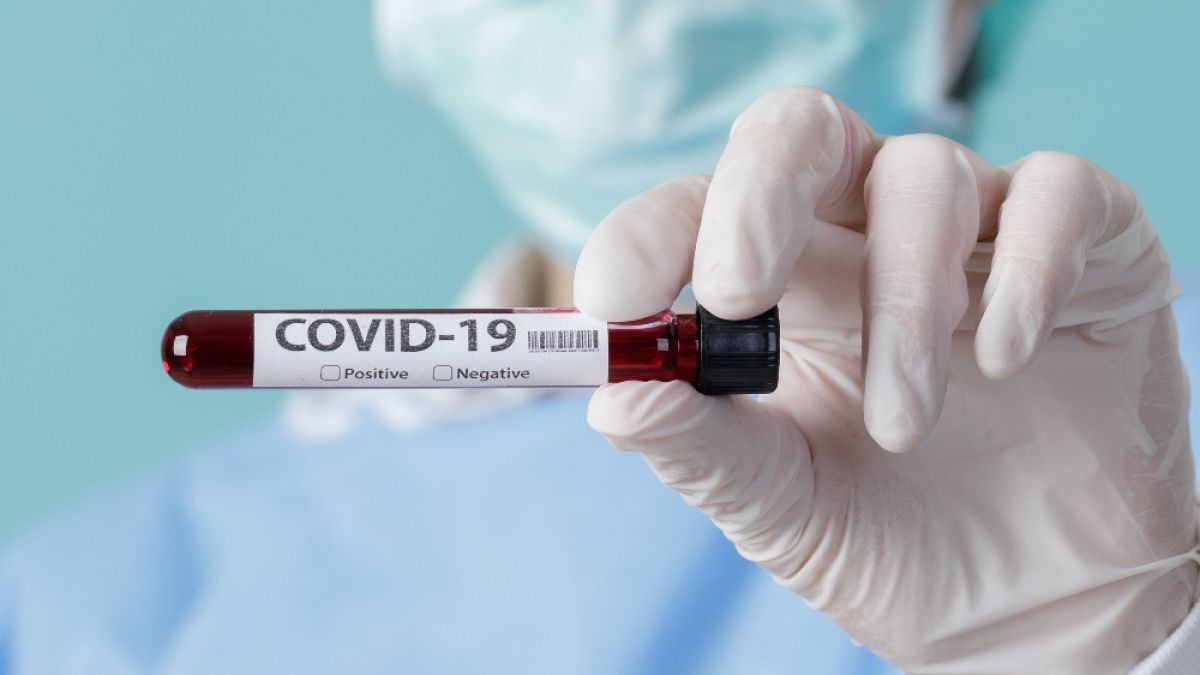 120 de oameni s-au vindecat de COVID-19 la domiciliu. 244 de persoane se află în stare gravă