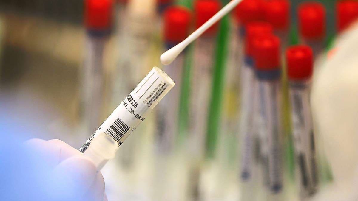 169 de cazuri noi de infectare și zece decese, provocate de COVID-19. Ultimele date ale Ministerului Sănătății