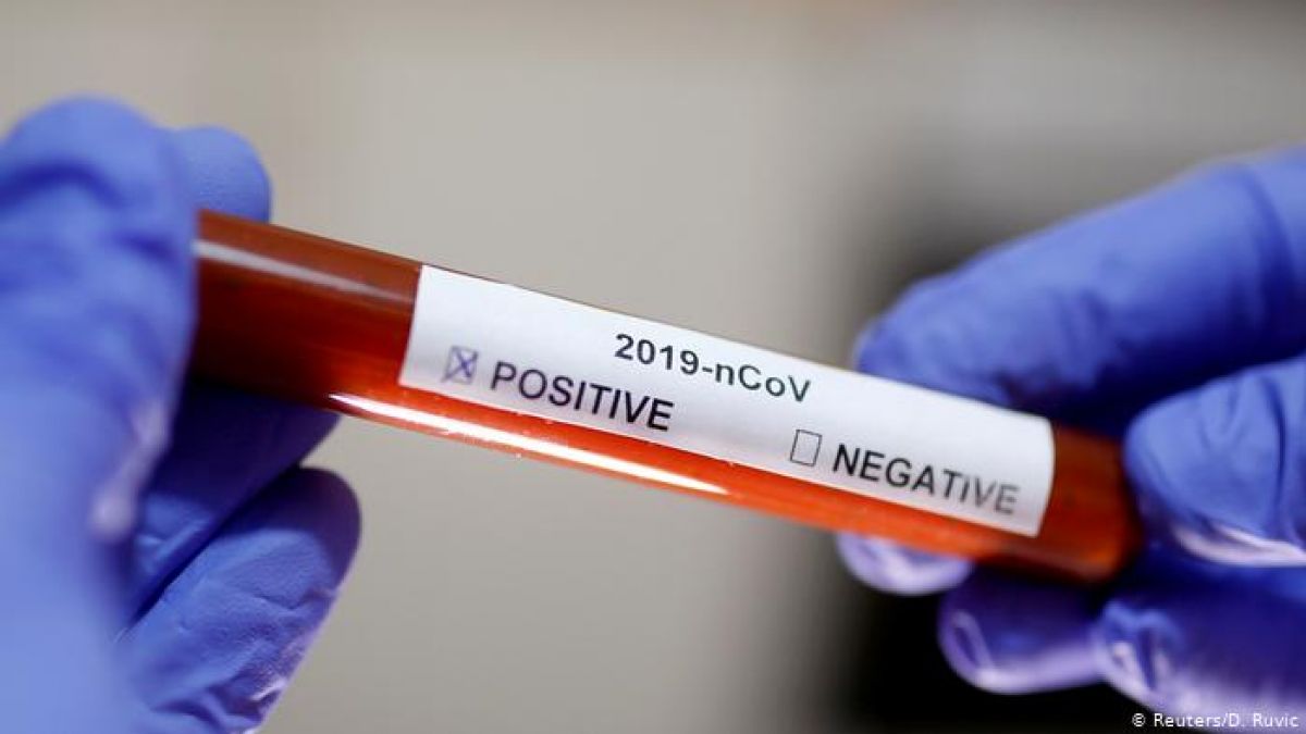 46 de pacienți, infectați cu COVID-19, în stare extrem de gravă. Ultimele date ale laboratoarelor din țară