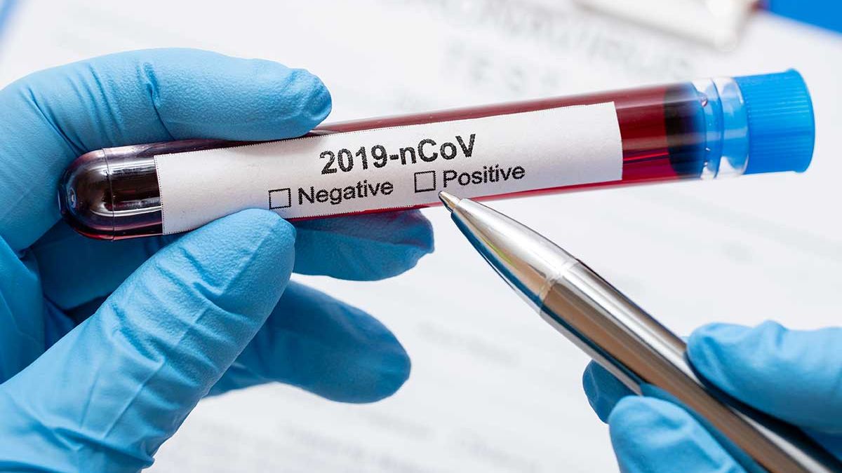 818 cazuri active de infecție cu coronavirus în R. Moldova. Sunt confirmate două cazuri de deces în stânga Nistrului