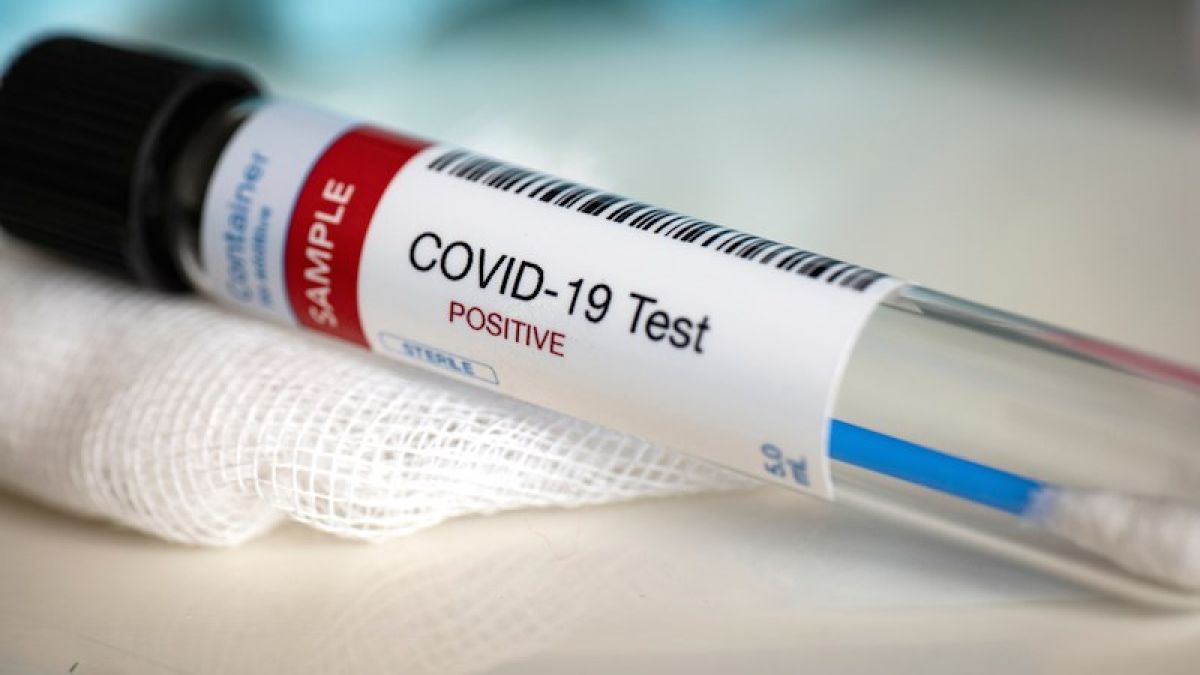 831 cazuri noi de COVID-19 și 14 decese. Ministerul Sănătății confirmă și decesul asistentei medicale de la Institutul Oncologic