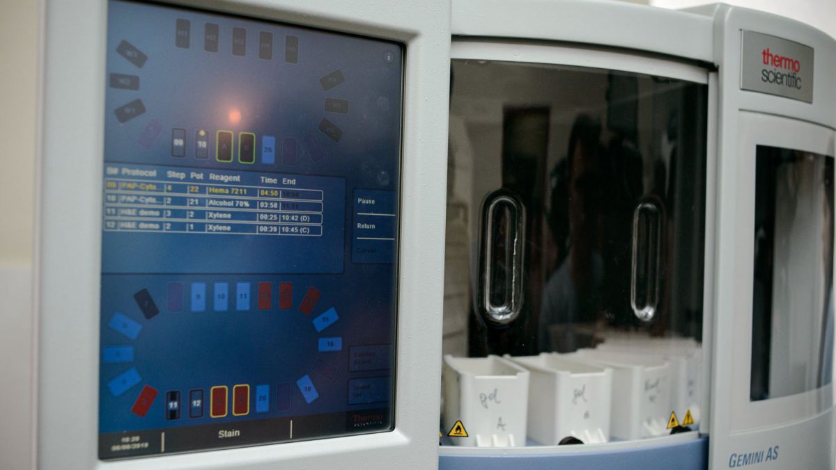 Două laboratoare din Moldova, dotate cu echipament performant pentru depistarea precoce a cancerului de col uterin