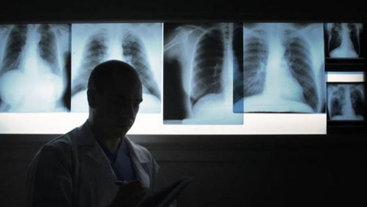 Haga: Au fost anunțate noi progrese în lupta împotriva tuberculozei