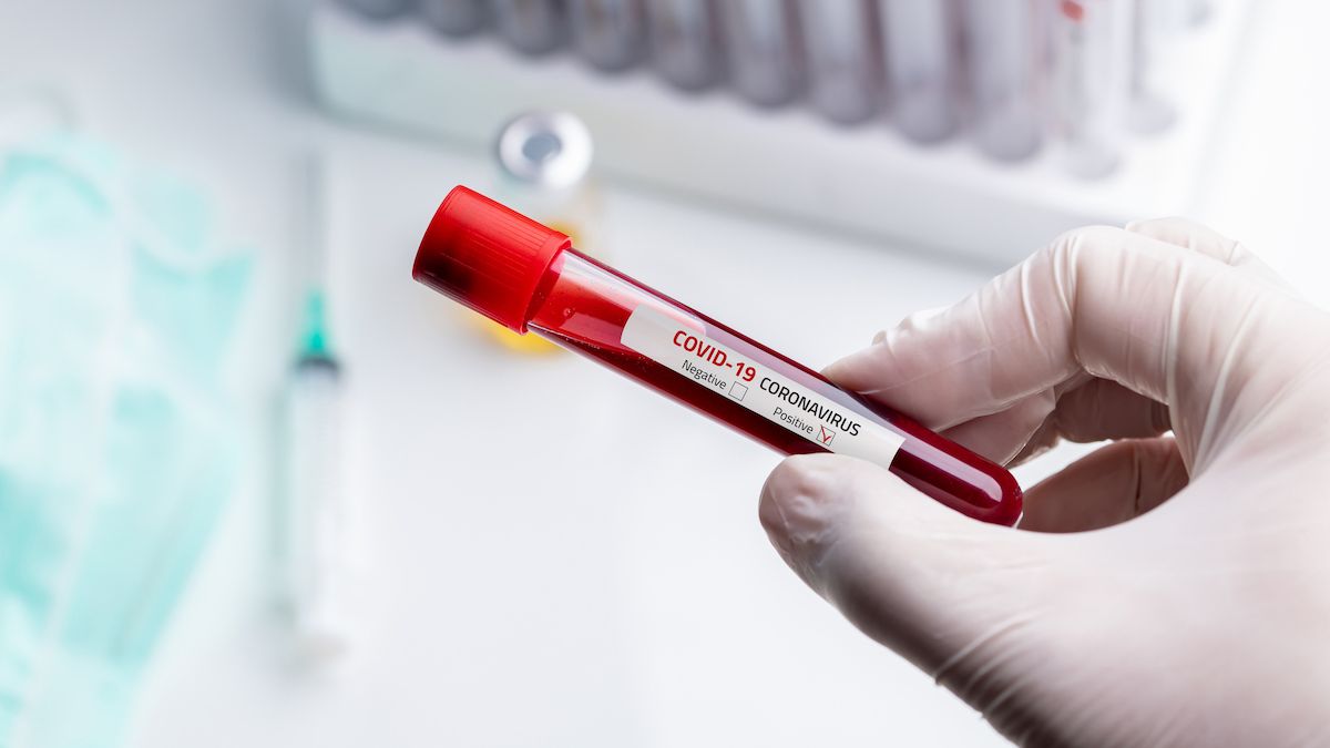 Încă patru cazuri confirmate de coronavirus în R. Moldova. Primul caz de transmitere locală