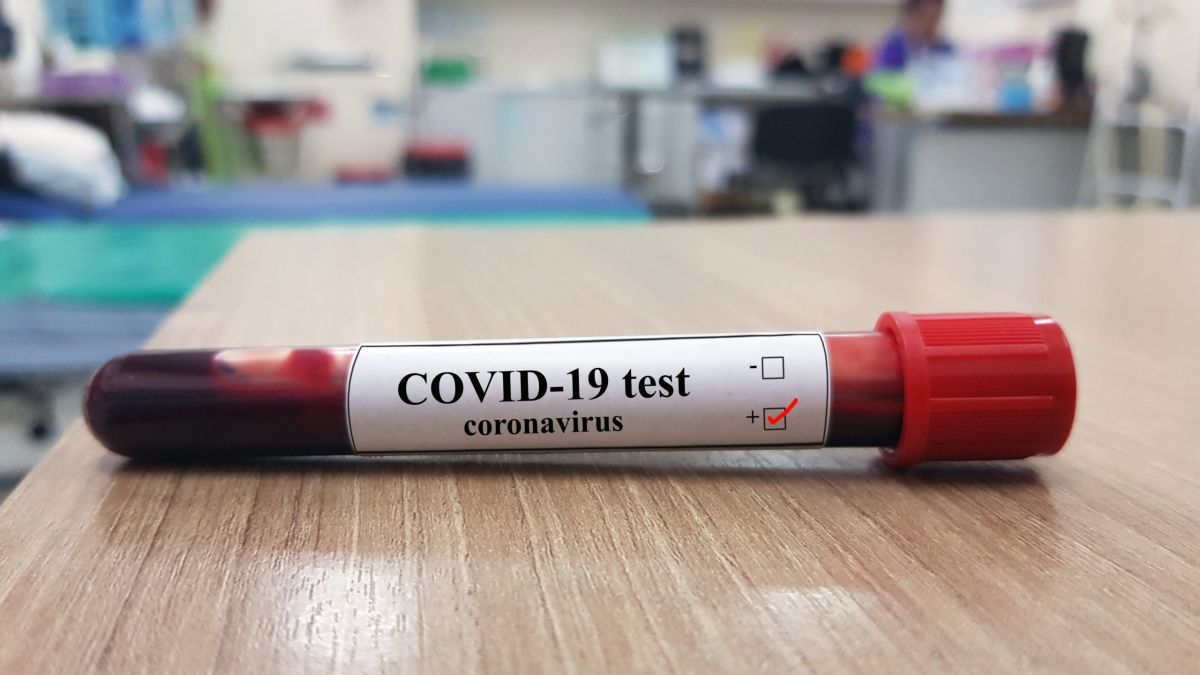 Încă trei decese cauzate de COVID-19. 16 persoane se află la respirație asistată