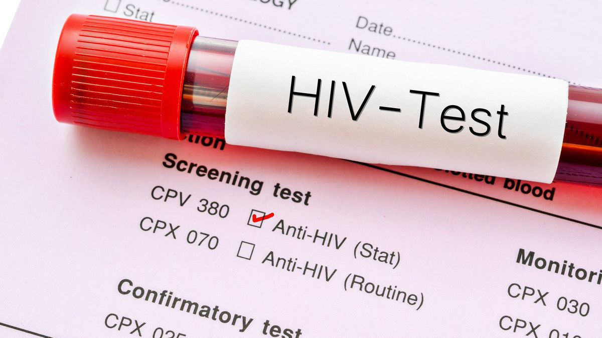 Numărul cazurilor noi de infecții cu HIV a crescut în Europa de Est și a scăzut în Occident