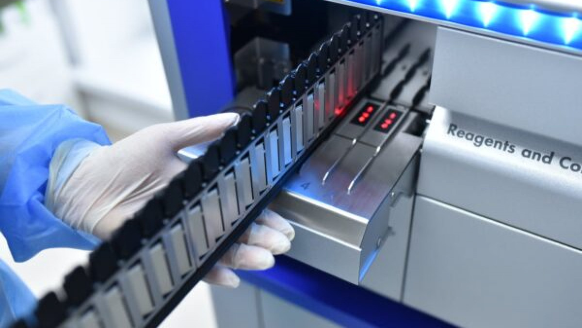 ANSP anunță că în R. Moldova a fost confirmată varianta Omicron a virusului SARS-CoV-2