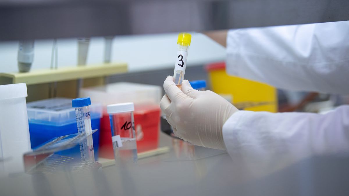 Câte teste mai au autoritățile pentru a depista coronavirusul? Răspunsul șefului ANSP
