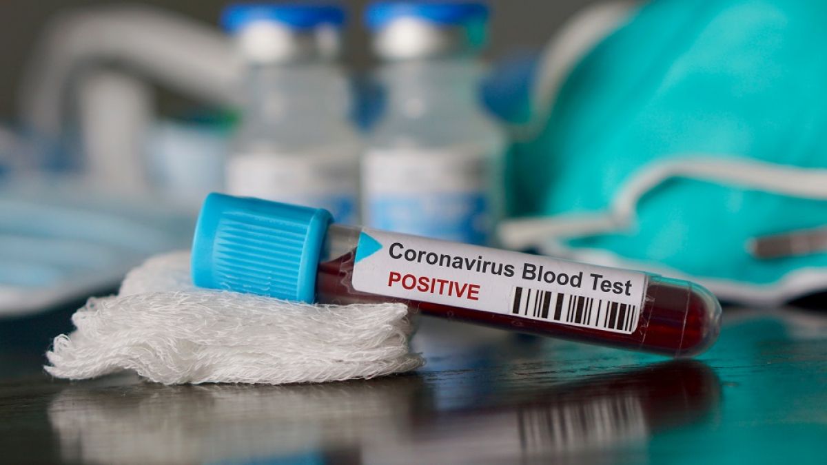 Alte 151 de persoane s-au infectat cu noul coronavirus. S-a înregistrat încă un deces