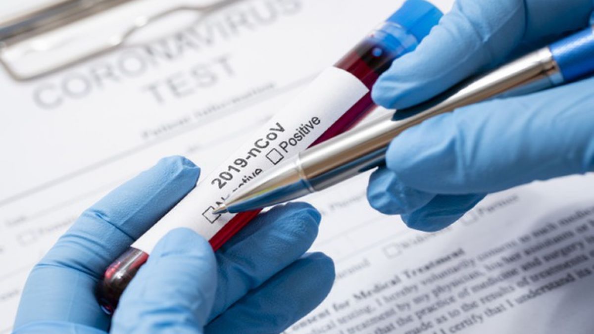 Crește numărul zilnic de infectări cu noul coronavirus. Autoritățile înregistrează alte 10 decese. Cea mai tânără victimă are 32 de ani