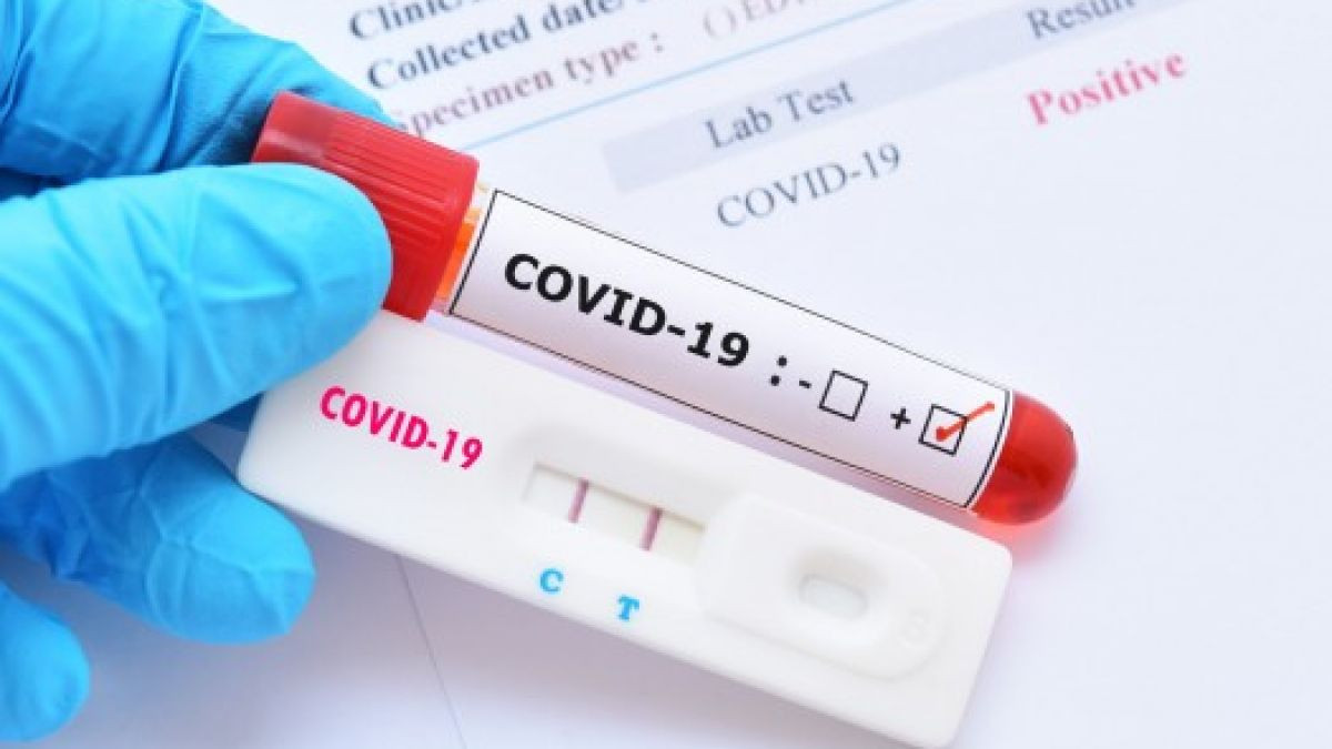 Datele Ministerului Sănătății: 232 de cazuri noi de infectare cu COVID-19 și două decese în regiunea transnistreană