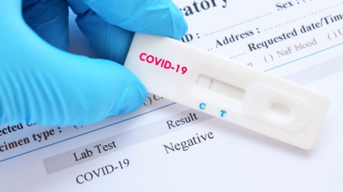 Dodon spune că și-a făcut test la COVID-19