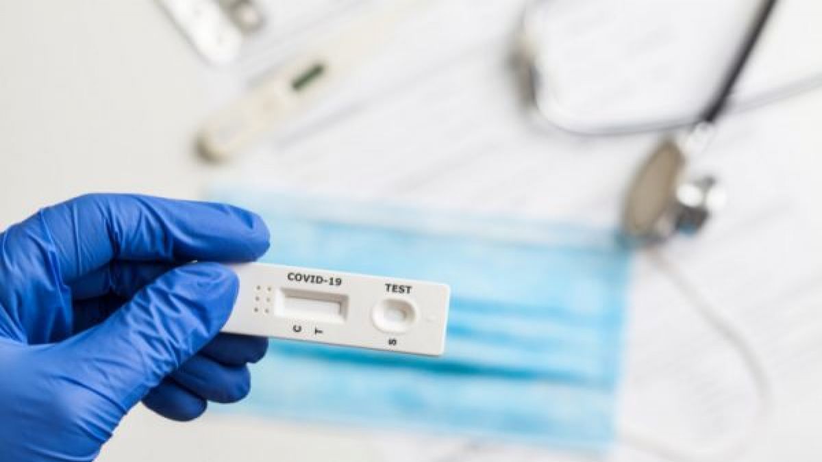 Instituțiile medicale din țară au fost dotate cu 100 de mii de teste rapide antigen la COVID-19