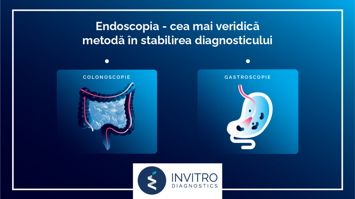 Invitro Diagnostics: Frica față de endoscopie – mituri și realitate