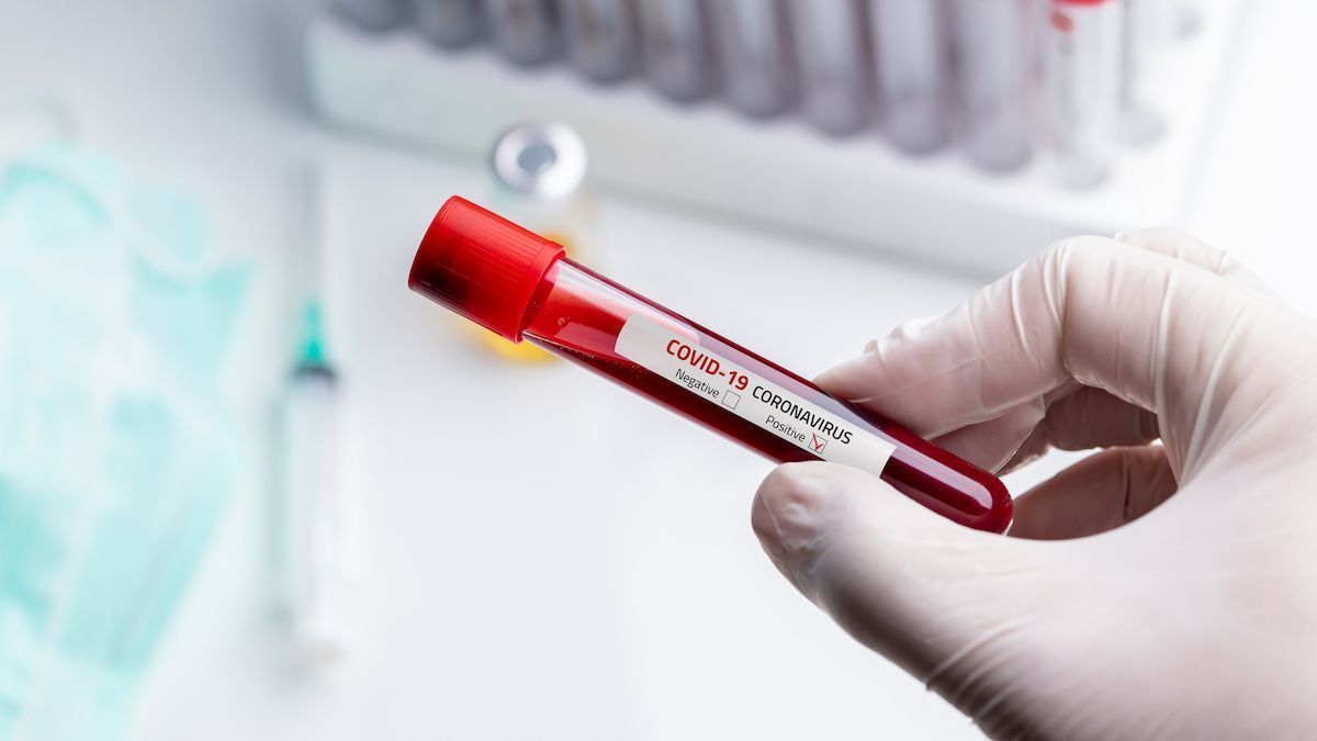 Laboratoarele din țară confirmă 77 de cazuri noi de COVID-19, iar spitalele anunță alte cinci decese