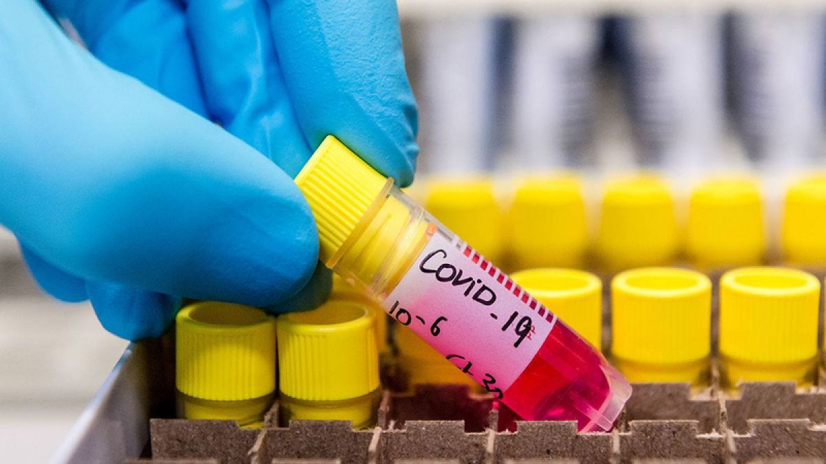 Numărul cazurilor de COVID-19 în R. Moldova a crescut cu 18% față de săptămâna trecută. S-a majorat și rata de infectare