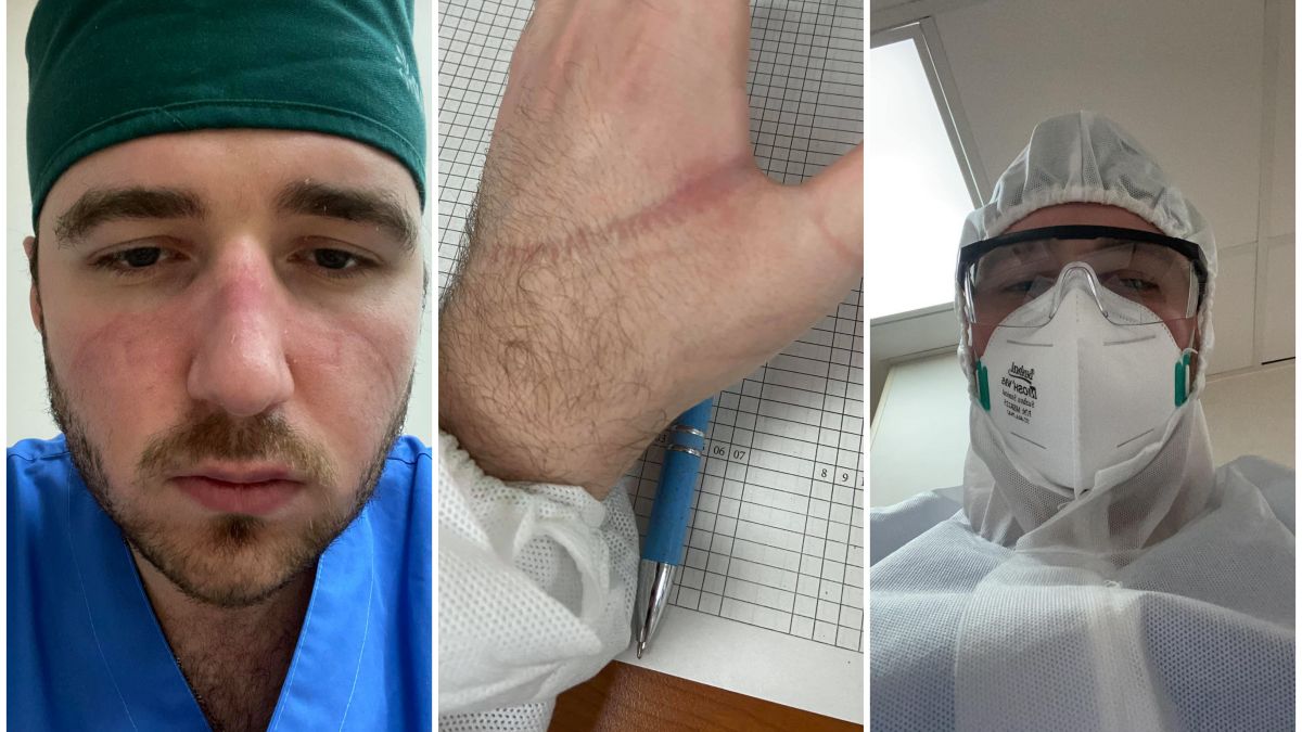 „O mască te poate proteja de un tub cât degetul de gros până în plămâni”: Mesajul unui asistent medical pentru cetățenii iresponsabili
