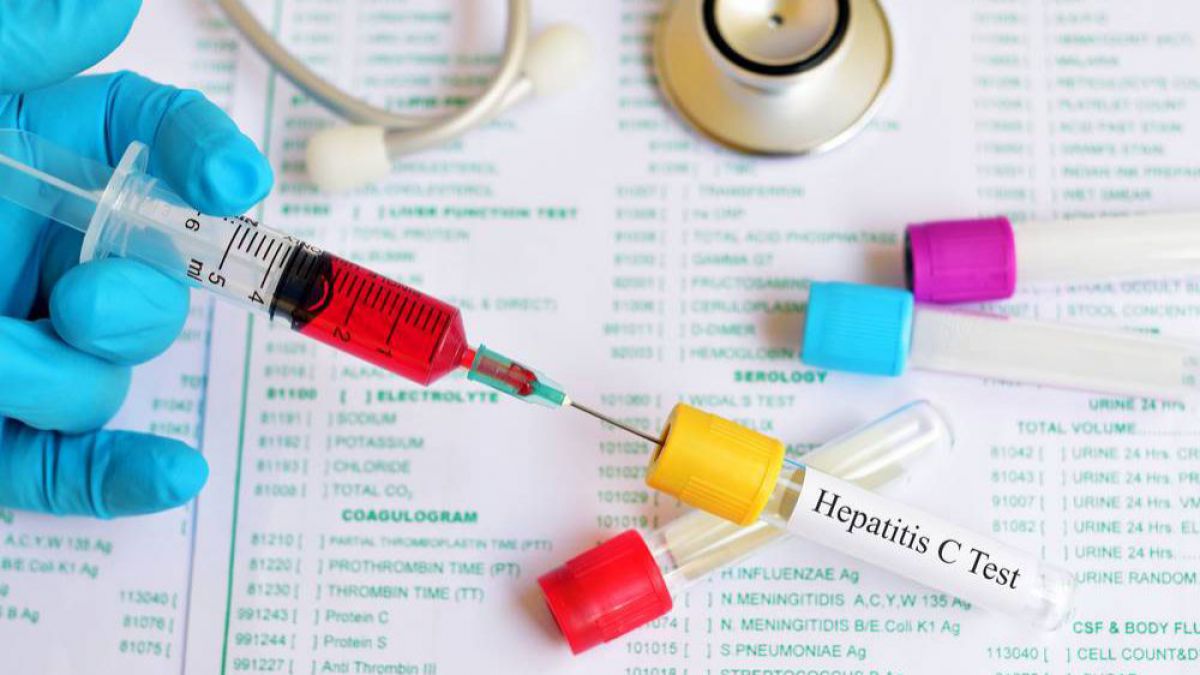 OMS: 325 de milioane de persoane din întreaga lume suferă de hepatită