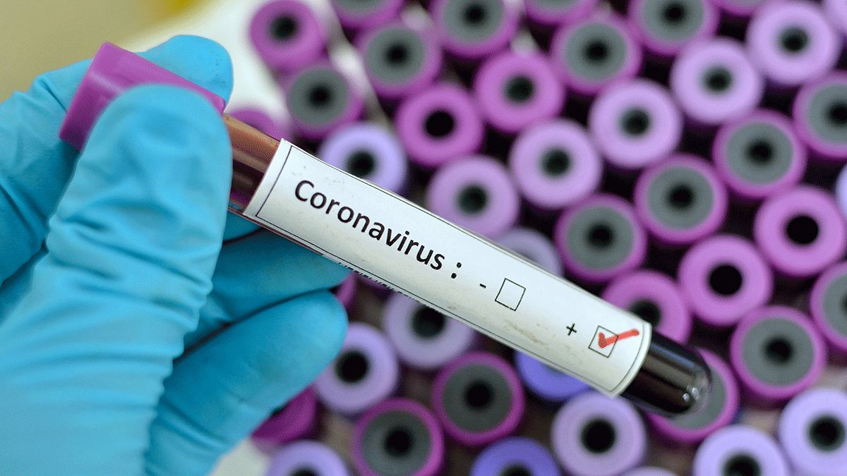 Opt cazuri de coronavirus sunt confirmate în Republica Moldova