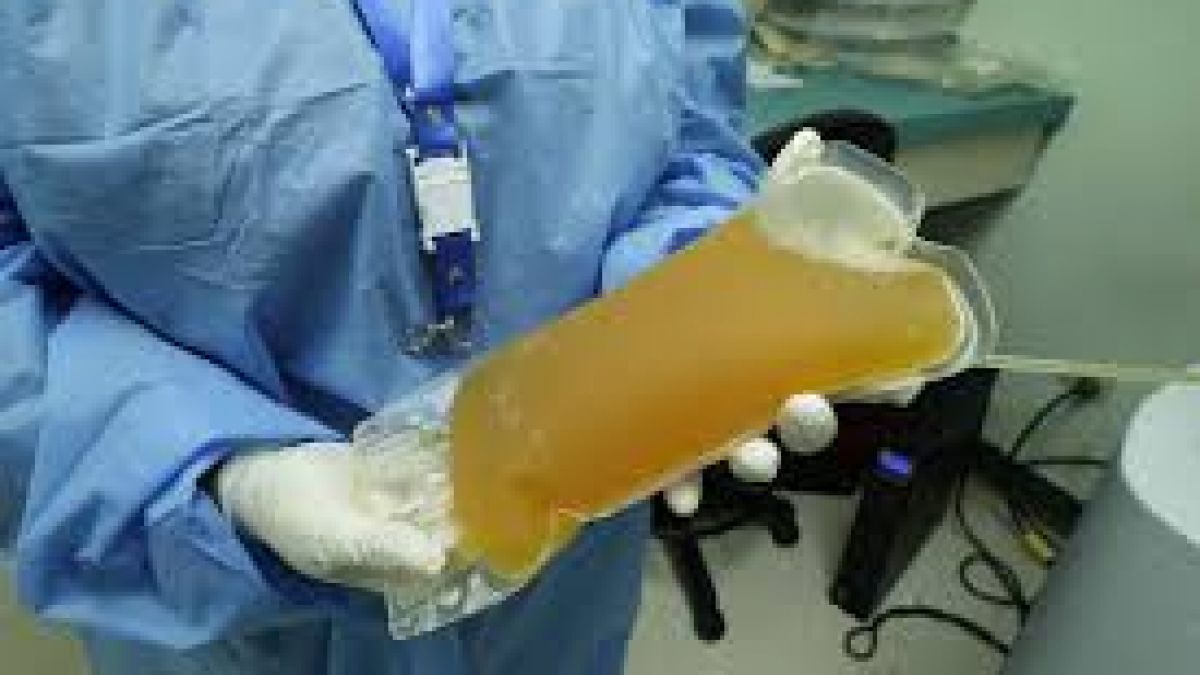 Peste 1.800 de doze de plasmă au fost direcționate în spitale pentru tratarea pacienților cu COVID-19