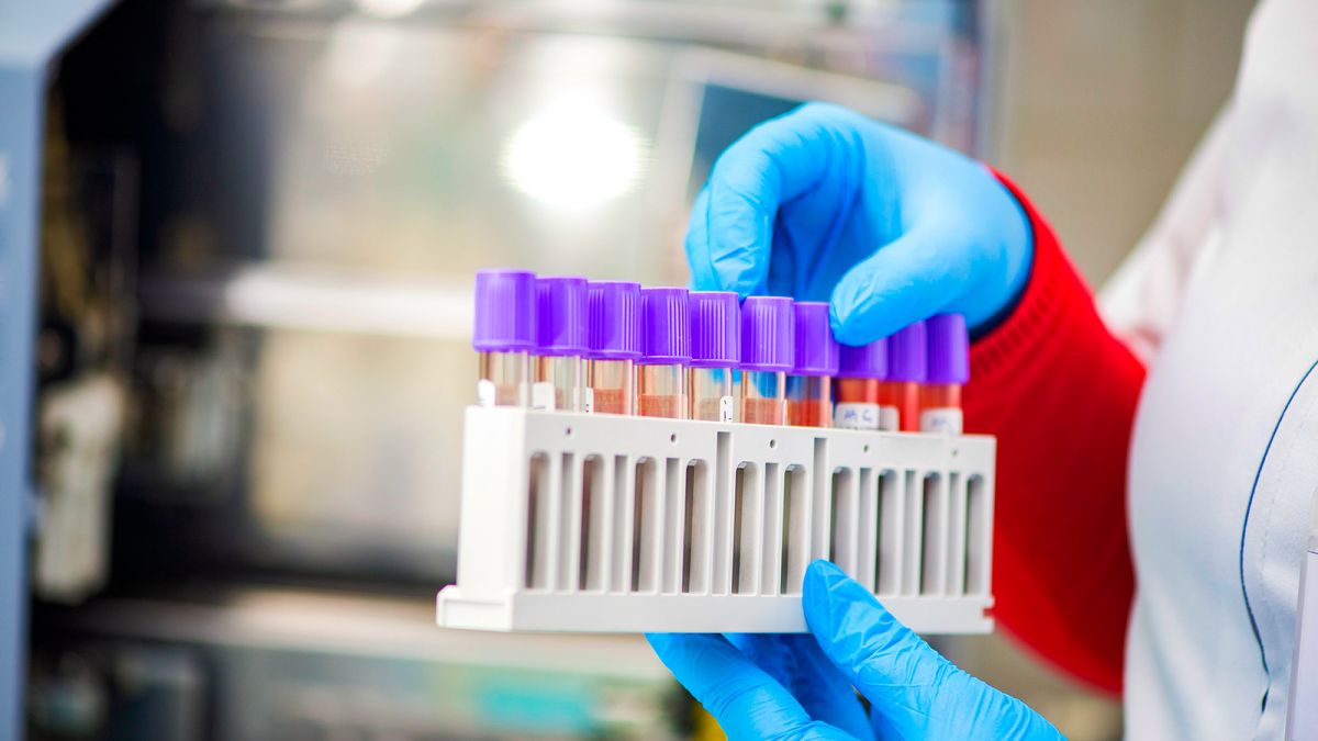 Sunt confirmate 122 cazuri noi de coronavirus în R. Moldova. Până acum s-au îmbolnăvit 1.560 de persoane