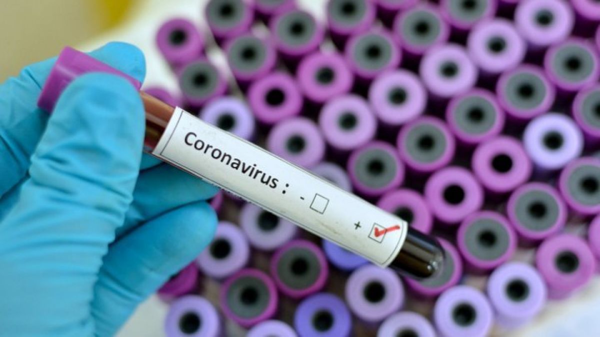 Testele de laborator confirmă 107 cazuri noi de îmbolnăvire cu COVID-19. Încă trei pacienți au decedat