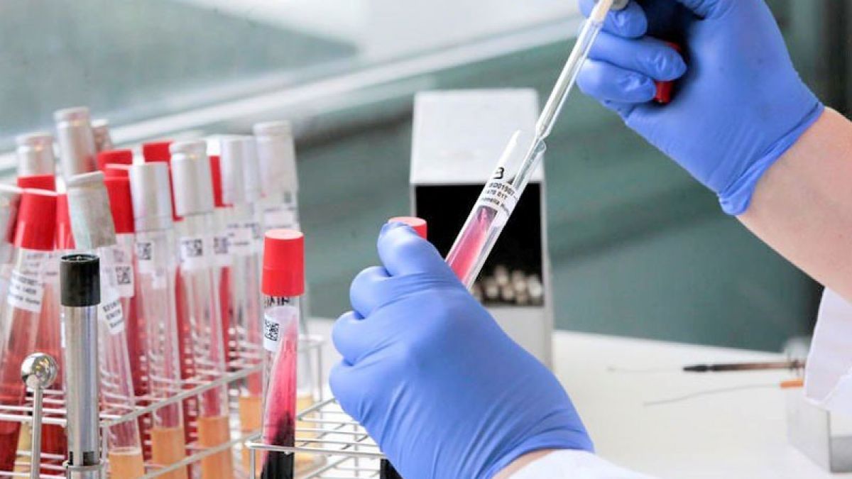 Testele de laborator confirmă 115 cazuri noi de COVID-19 în R. Moldova