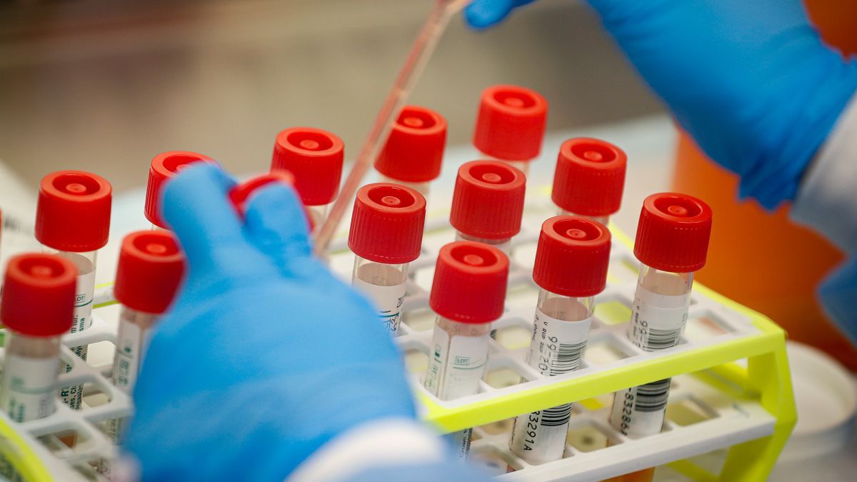 11 cazuri noi de coronavirus, confirmate în Republica Moldova. Un copil, printre infectați