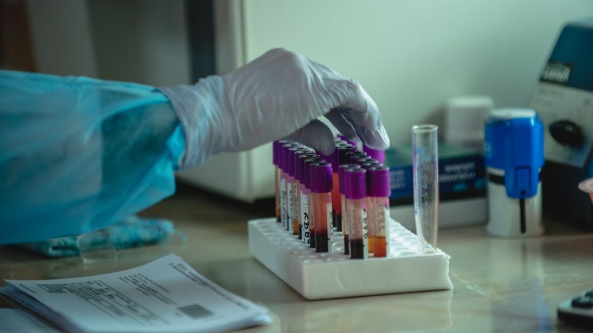 Un nou studiu clinic, destinat tratamentului infecției COVID-19, aprobat de Comisia Medicamentului