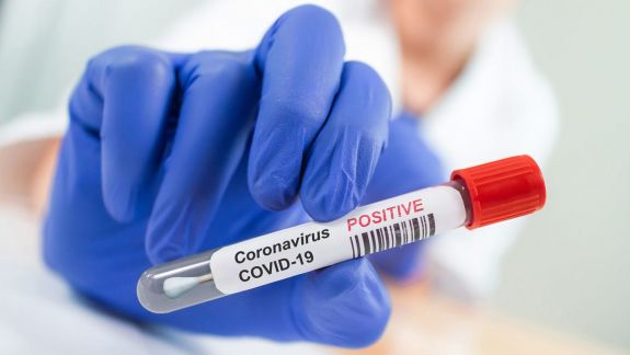 324 de cazuri noi de COVID-19 în Republica Moldova: Bilanțul infectărilor a urcat la 39.797