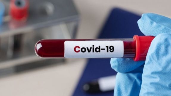 1459 de moldoveni au fost testați pozitiv cu coronavirusul de tip nou. Printre ei, 65 de lucrători medicali