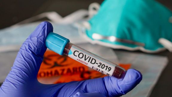 Încă 560 de moldoveni s-au infectat cu COVID-19 în ultimele 24 de ore. Virusul a luat viața a 10 pacienți