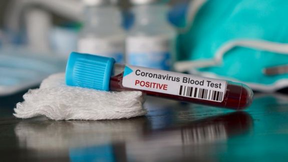 Șase cazuri de coronavirus confirmate în România