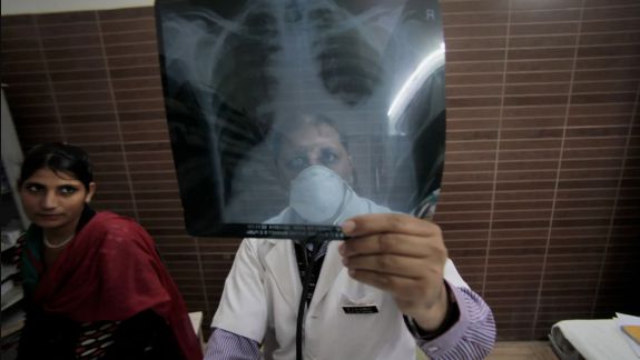 Tuberculoza rămâne o „provocare majoră de sănătate” în Asia Centrală şi Europa