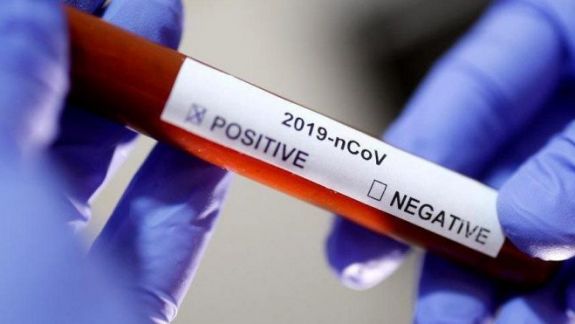 Aproape 5.000 de teste procesate, rezultate cu 60 de cazuri pozitive de infecție cu noul coronavirus, în ultimele 24 de ore. Doi pacienți au decedat