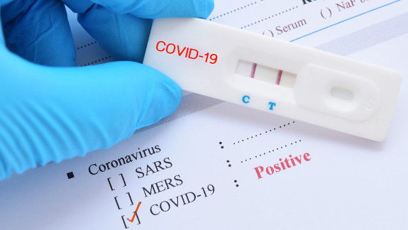 Circa 4.000 de persoane, confirmate pozitiv la infecția cu COVID-19 în ultima săptămână. Iată volumul testărilor