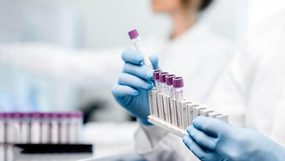 În decurs de o săptămână, laboratoarele din țară au procesat peste 13 mii de teste la COVID-19. Iată numărul rezultatelor pozitive