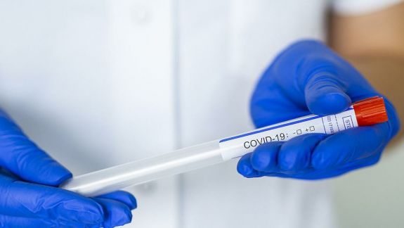 Mai mulți moldoveni vor fi testați de COVID-19. Laboratoarele pregătesc realizarea a peste șase, șapte mii de teste zilnic