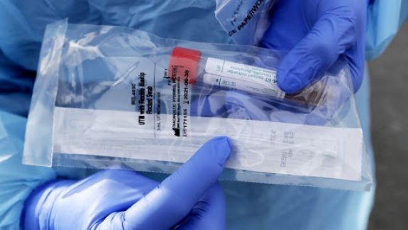 Laboratoarele ANSP dispun de 70.000 de teste pentru diagnosticarea COVID-19. Dumbrăveanu: Urmează să achiziționăm încă 100.000 de unități