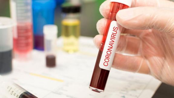 Un nou studiu clinic privind tratamentul infecției COVID-19 a fost aprobat în R. Moldova