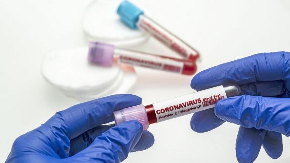 83 de cazuri noi de coronavirus în Republica Moldova
