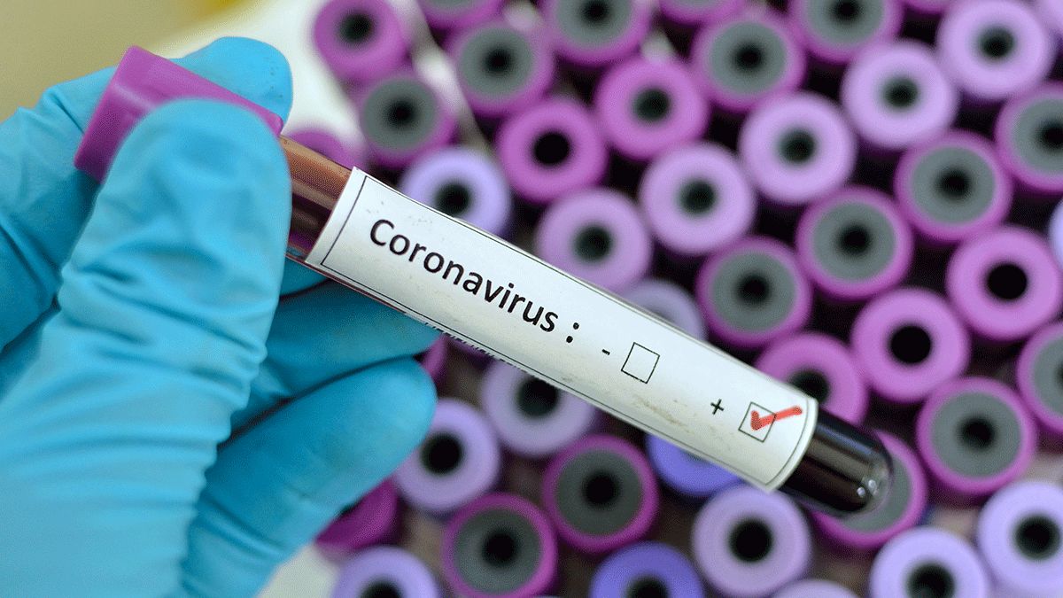 Au fost confirmate încă două cazuri de coronavirus în R. Moldova 