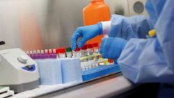 R. Moldova dispune de 15 mii de teste pentru diagnosticarea COVID-19. Chicu: Problema este în capacitatea limitată a laboratoarelor